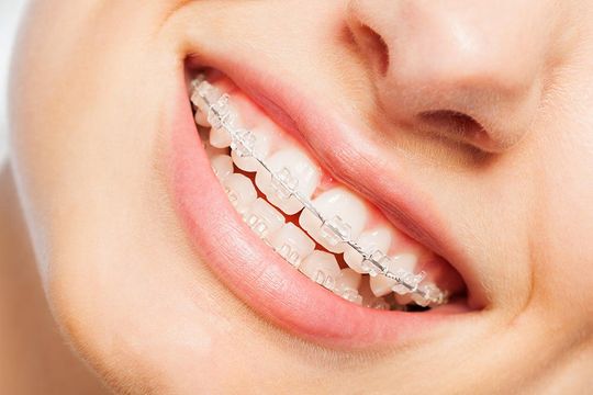 Zahnspange Zahnarzt